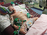 Joe Way in PICU Bristol Childrens Hospital